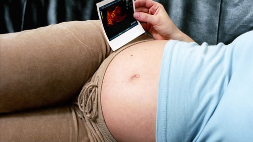 Eine schwangere Frau mit Ultraschallaufnahme
