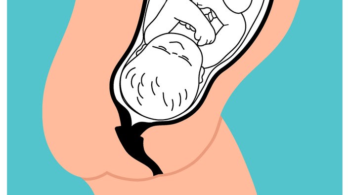 Grafik: Baby im Bauch der Mutter