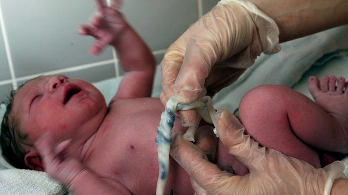 Eine Schere wird an die Nabelschnur eines Neugeborenen angesetzt