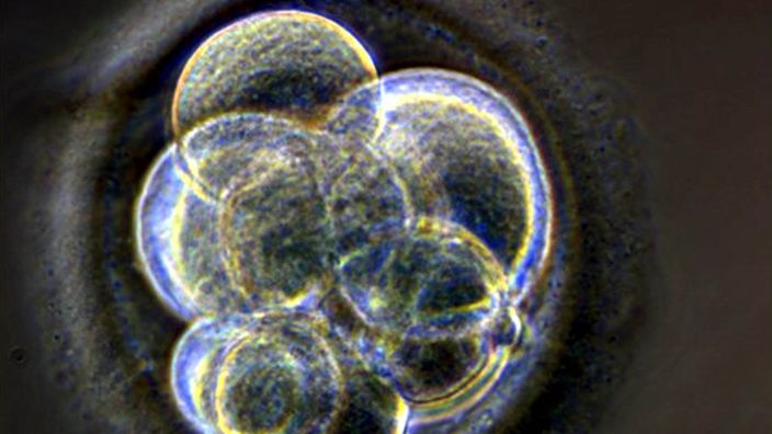 Eine Zellanhäufung: ein drei Tage alter Embryo.
