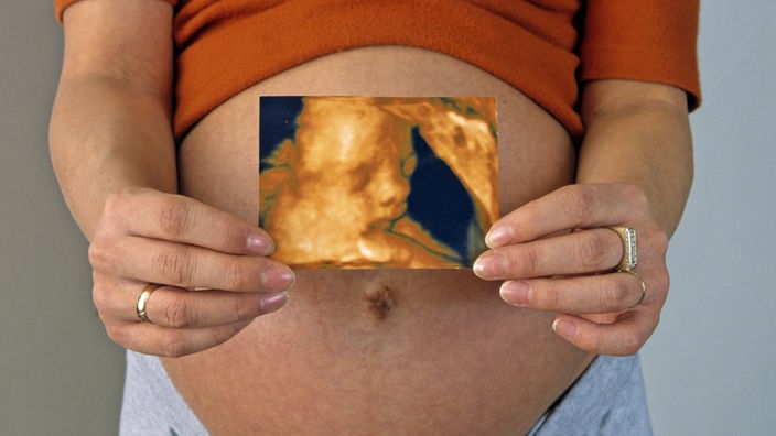Eine hochschwangere Frau hält das 3-D-Foto ihres Fötus' vor ihren nackten Bauch.