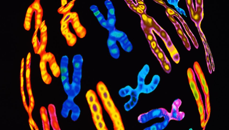 Menschliche Chromosomen (Elektronenmikroskop-Aufnahme)