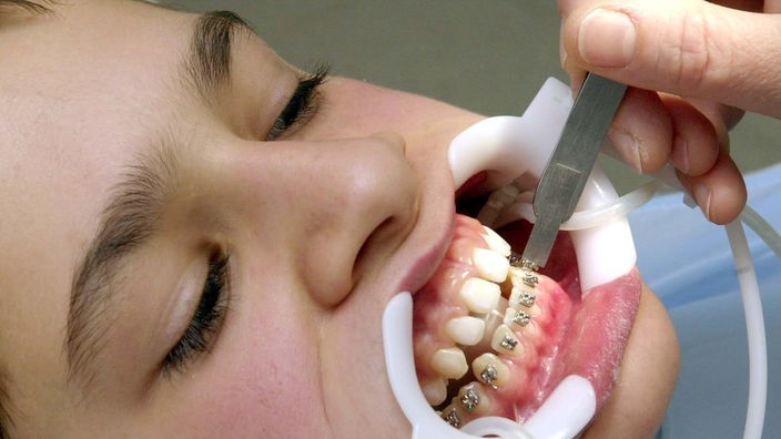 Ein Junge mit Zahnspange wird von einem Zahnarzt behandelt
