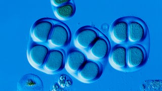 Mikroaufnahme von Cyanobakterien