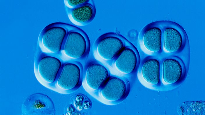 Mikroaufnahme von Cyanobakterien