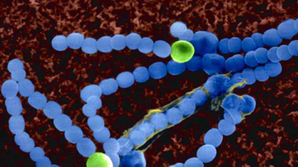 Elektronenmikroskopische Aufnahme kettenförmiger Cyanobakterien.