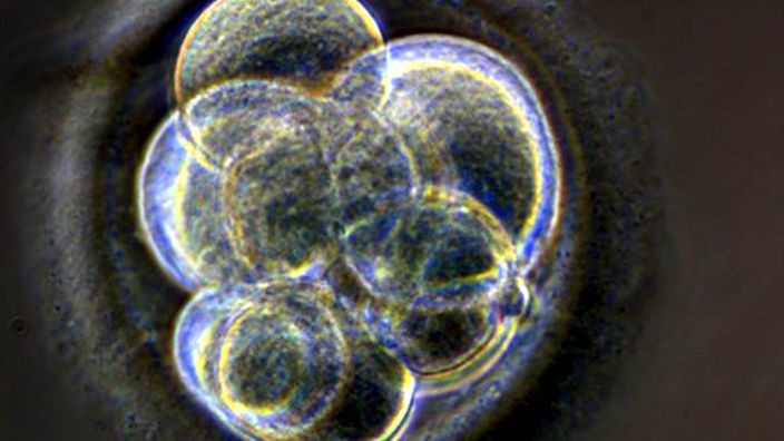 Geteilte Eizellen eines menschlichen Klons nach drei Tagen