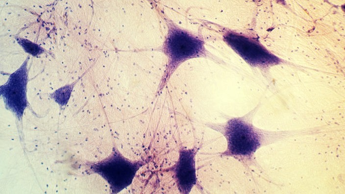 Neuronen in einem menschlichen Gehirn.