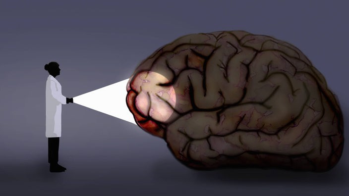 Wissenschaftlerin strahlt mit einer Taschenlampe auf ein menschliches Gehirn
