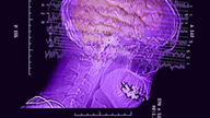 Röntgenbild eines menschlichen Schädels mit darüber gelegten EEG-Wellen.