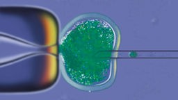 Mikroskopaufnahme: Ein Spermium wird mit einer Nadel in eine Eizelle gespritzt.
