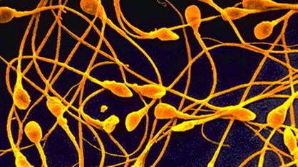Mikroskopische Aufnahme von Spermien.