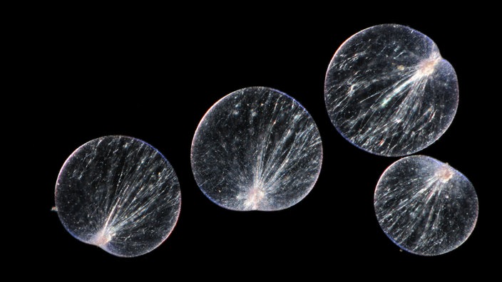 Mikroskopaufnahme des Einzellers Dinoflagellat | Bildquelle: WDR / picture alliance / blickwinkel/S Mikroskopaufnahme des Einzellers Dinoflagellat