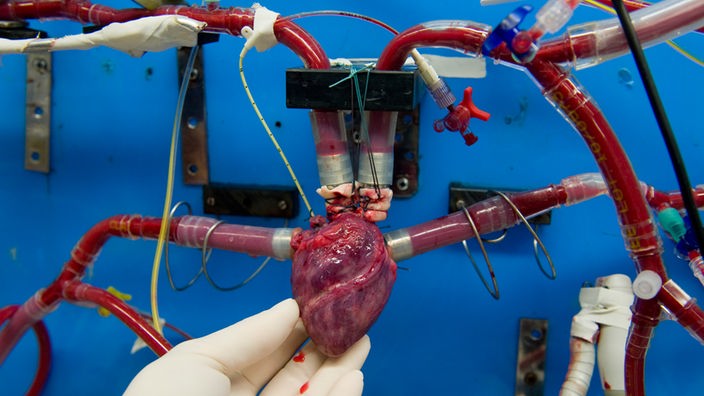 Ein Herzchirurg hält ein Schweineherz, das an einen externen Blutkreislauf angeschlossen ist.