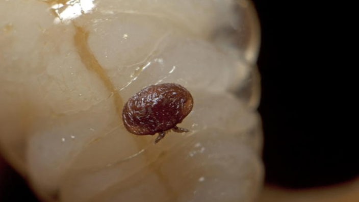 Varroa-Milbe sitzt auf Larve einer Honigbiene.