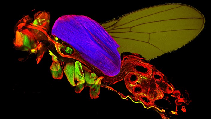 Angefärbte Muskeln der drosophila melanogaster unter dem Lichtmikroskop | Bildquelle: Frank Schnorrer Angefärbte Muskeln der drosophila melanogaster unter dem Lichtmikroskop