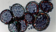 Mikroskopaufnahme: Bläulich gefärbte runde Bakterien haften aneinander.