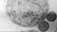 Mikroskopaufnahme eines Ultradünnschnittes: Zwei kleine Kugeln (Nanoarchaeum equitans) haften an einer größeren Kugel (Ignicoccus).
