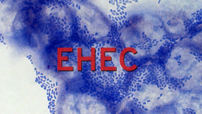 Ehec-Keime heften sich fest an die Darmzellen mit roter Überschrift "EHEC".