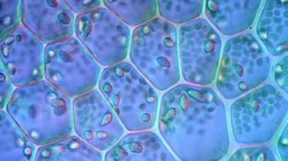 Mikroskop-Aufnahme von Pflanzenzellen, in denen grün die ovalen Chloroplasten zu erkennen sind.