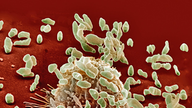 Rasterelektronenmikroskopische Aufnahme: Ein Bakterium ist von menschlichen Fresszellen belagert.