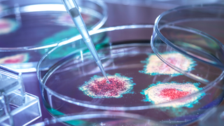 Pipette, die eine Flüssigkeit auf Bakterienkulturen in der Petrischale träufelt.