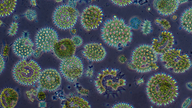 Chlorophyta, das sind grüne Algen, unterm Mikroskop.