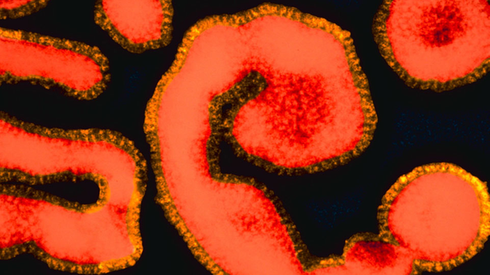 Grippevirus unter dem Mikroskop: Rote wurmartige Fäden schwimmen vor schwarzem Hintergrund.