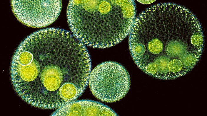 Mikroskopaufnahme der Kugelalge Volvox aureus. | Bildquelle: WDR/Mauritius/Roland Birke Mikroskopaufnahme der Kugelalge Volvox aureus.