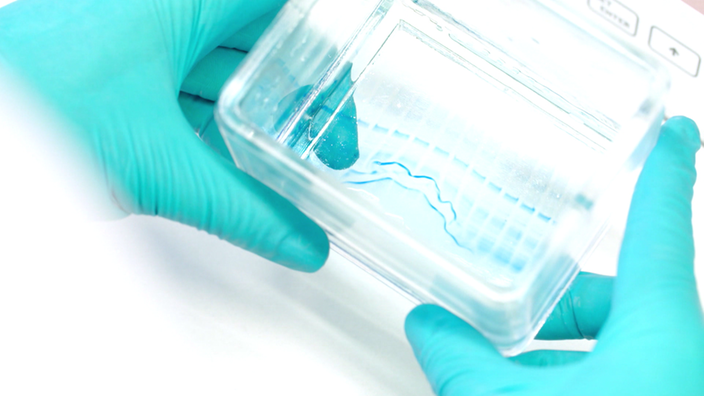 Im Schälchen: Proteinbanden der Gelelektrophorese. | Bildquelle: SWR Im Schälchen: Proteinbanden der Gelelektrophorese.