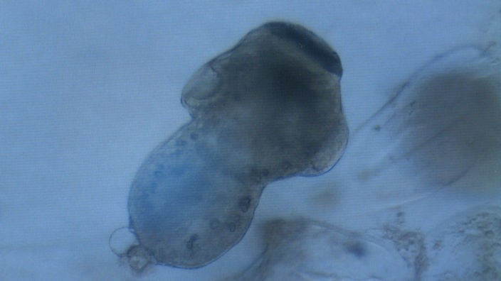 Ein adulter Fuchsbandwurm unter dem Mikroskop.