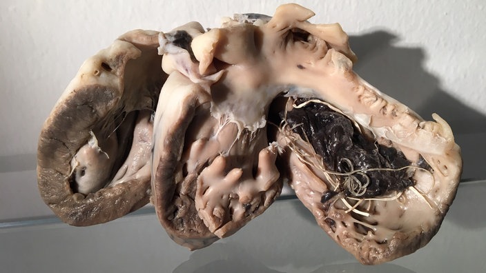 Ein mit Herzwürmern befallenes, plastiniertes Hundeherz.