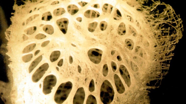 Das Skelett des Gießkannenschwamms Euplectella aspergillum. | Bildquelle: Prof. W.E.G. Müller/Universität Mainz Das Skelett des Gießkannenschwamms Euplectella aspergillum.