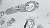 schwarz-weiß Ansicht von Bakterien unter einem Mikroskop
