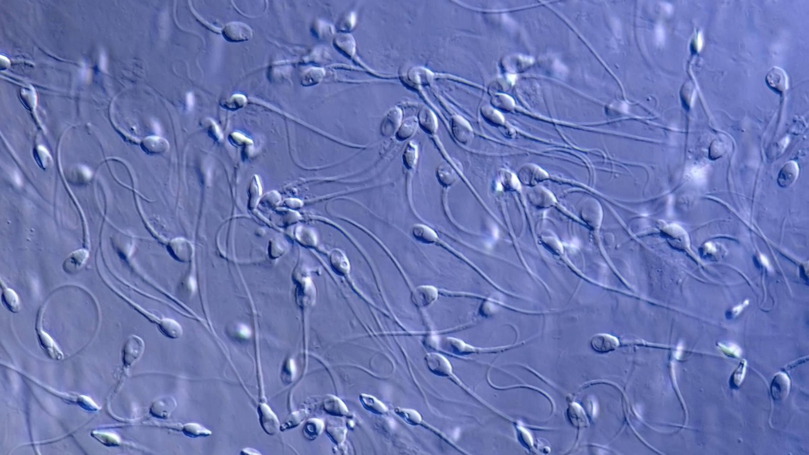 Mikroskop-Aufnahme von menschlichen Spermien
