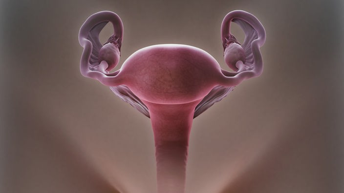 Grafik: ein anatomisches Modell der Gebärmutter und der Eierstöcke 