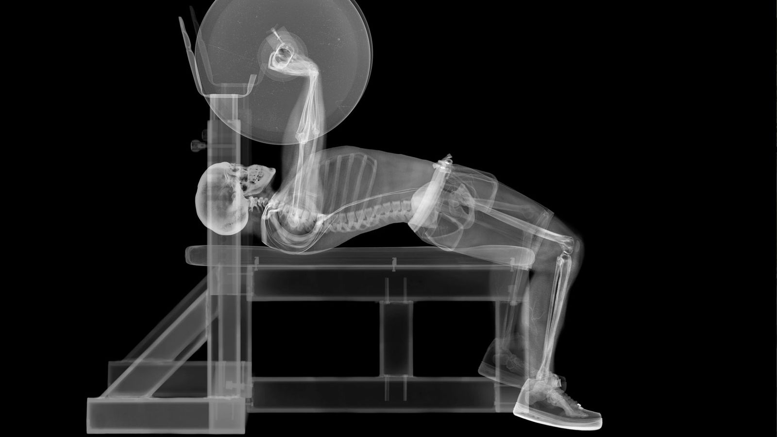 Röntgenaufnahme eines Gewichthebers