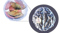 Animiertes Bild eines Gehirns mit Parasiten.