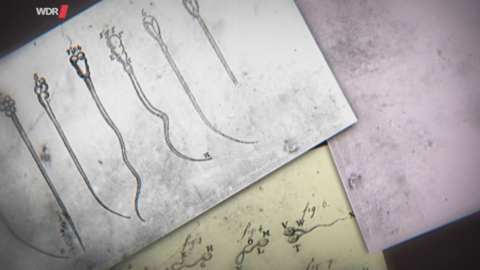 Alte anatomische Zeichnungen von einzelnen Spermien