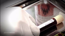 Eine Hand im weißen Handschuh legt eine Blutprobe in einem beschrifteten Transportröhrchen auf ein Metallschale.
