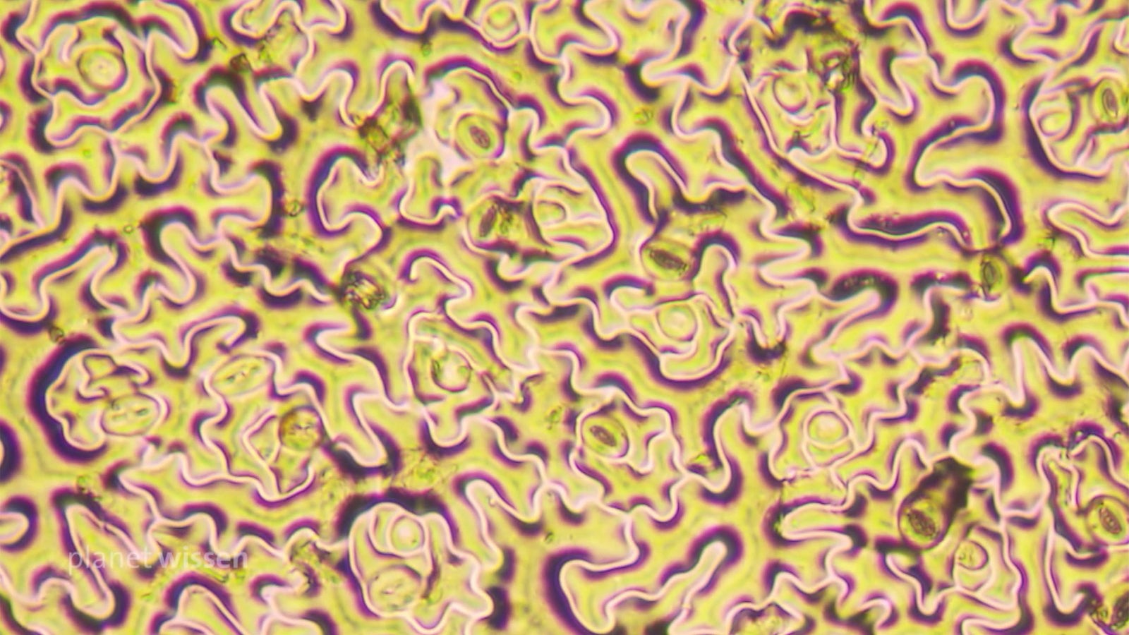 Pflanzenblatt unter dem Mikroskop: Zu sehen sind gewundene Strukturen, die an ein Gehirn erinnern.