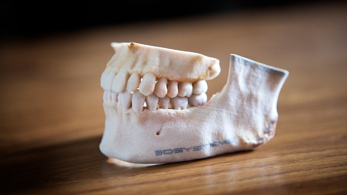 Kiefergebiss aus dem 3D-Drucker | Bildquelle: mauritius images / BSIP Kiefergebiss aus dem 3D-Drucker