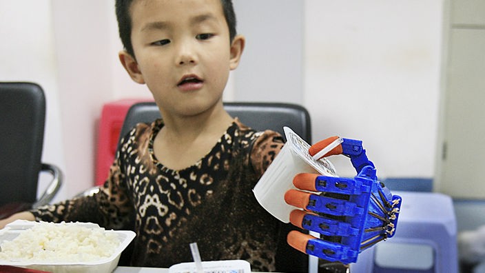 Chinesischer Junge greift mit seiner Prothese einen Plastikbecher 