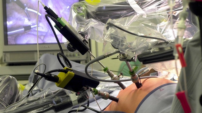 Drei Roboterarme stecken OP-Instrumente in einen Bauch. | Bildquelle: ddp/Carsten Koall Drei Roboterarme stecken OP-Instrumente in einen Bauch.