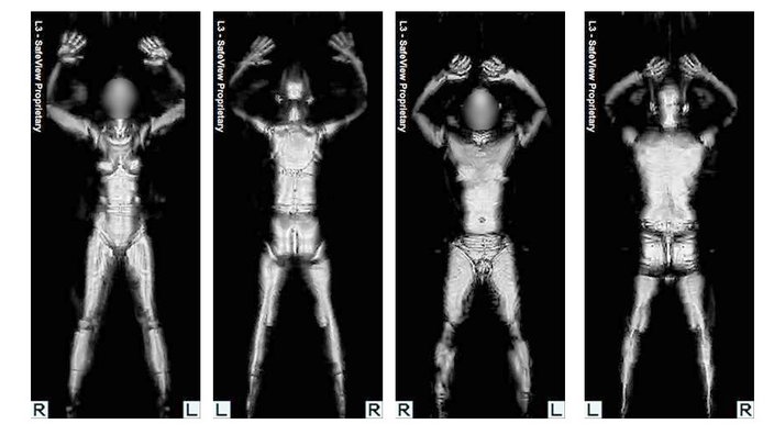 Das Bild zeigt die Darstellung eines Körperscanners, zwei gescannte Menschen ohne Kleidung. Das Bild entstand mithilfe eines Röntgenscanners. | Bildquelle: WDR/dpa Das Bild zeigt die Darstellung eines Körperscanners, zwei gescannte Menschen ohne Kleidung. Das Bild entstand mithilfe eines Röntgenscanners.